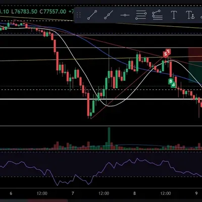 $ 100회 챌린지 1/100, 1승 $